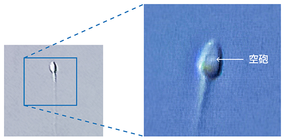 IMSI 精子異常構造